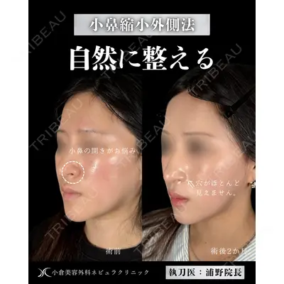 神戸美容外科 ネビュラクリニックの症例