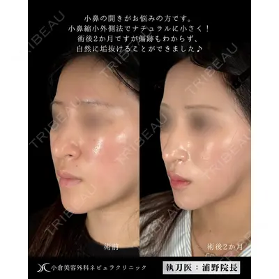 神戸美容外科 ネビュラクリニックの症例