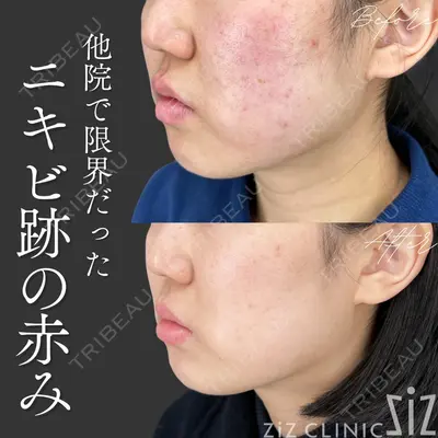 ziz CLINIC 村岡 史子医師の症例
