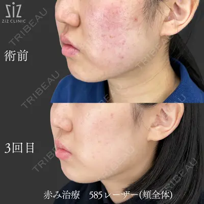 ziz CLINIC 村岡 史子医師の症例