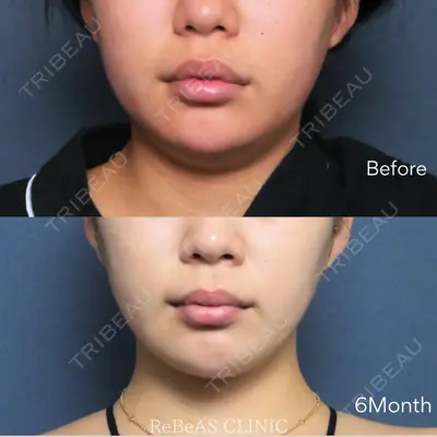 ReBeAS CLINIC 清水 志乃医師の症例
