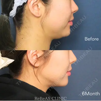 ReBeAS CLINIC 清水 志乃医師の症例