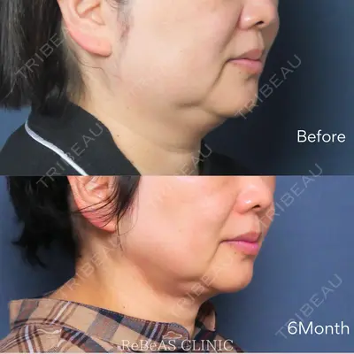 ReBeAS CLINIC 清水 志乃医師の症例