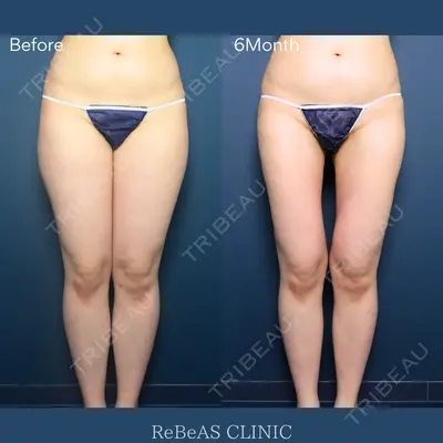 ReBeAS CLINIC 清水 志乃医師の症例