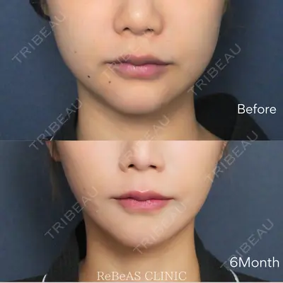 ReBeAS CLINICの症例