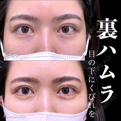 EMMO FACE CLINIC 大宮院 百瀬 直也医師の症例