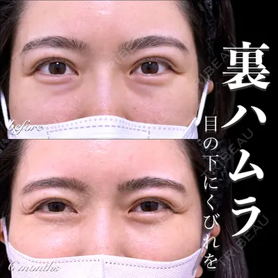 EMMO FACE CLINIC 大宮院 百瀬 直也医師の症例