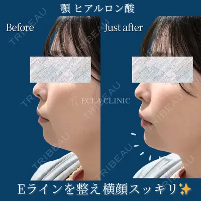 ECLA CLINIC (エクラクリニック) 緒方 善孝医師の症例