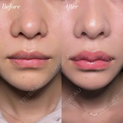 R Beauty CLINIC 大阪院 小池 泰弘医師の症例
