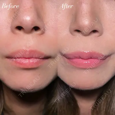 R Beauty CLINIC 大阪院 小池 泰弘医師の症例