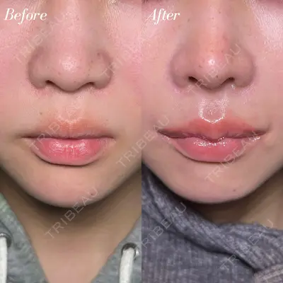 R Beauty CLINIC 大阪院 小池 泰弘医師の症例