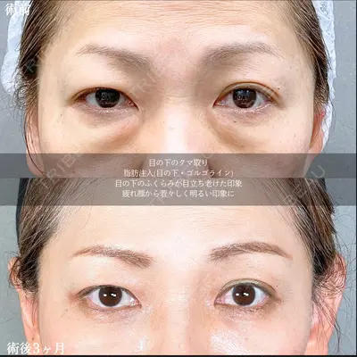 アリエル美容クリニック 大宮院 鈴木　桂介医師の症例