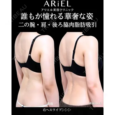 アリエル美容クリニック 横浜院 加藤 敏次医師の症例