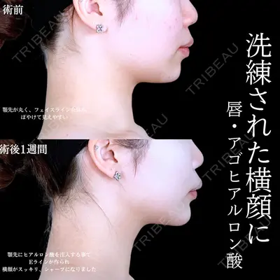 アリエル美容クリニック 水戸院 天白 典秀医師の症例