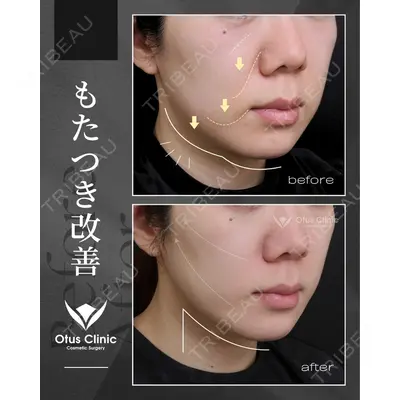 Otus Clinic 【オータスクリニック】 中 徳太郎医師の症例