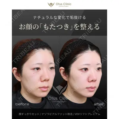 Otus Clinic 【オータスクリニック】 中 徳太郎医師の症例