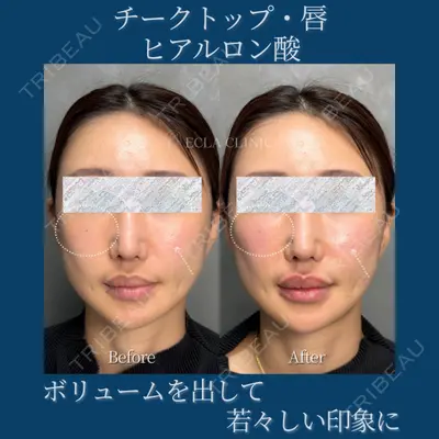 ECLA CLINIC (エクラクリニック) 緒方 善孝医師の症例