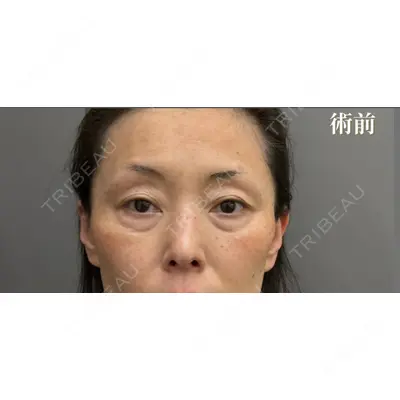 お茶の水美容形成クリニック 吉井 健吾医師の症例