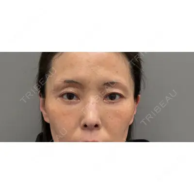 お茶の水美容形成クリニック 吉井 健吾医師の症例