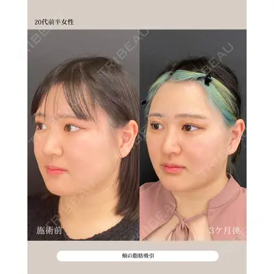自由が丘ウェルエイジングビューティークリニック 福田 知佐子医師の症例