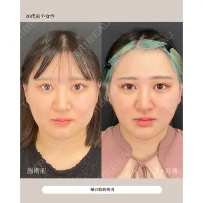 自由が丘ウェルエイジングビューティークリニック 福田 知佐子医師の症例
