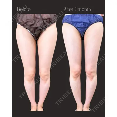 IANA CLINIC 穴井 元康医師の症例
