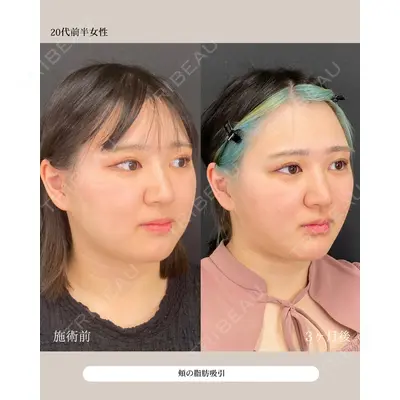 自由が丘ウェルエイジングビューティークリニック 福田 知佐子医師の症例