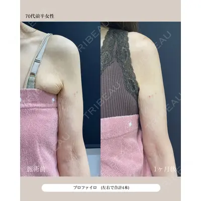 自由が丘ウェルエイジングビューティークリニック 福田 知佐子医師の症例