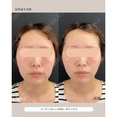 自由が丘ウェルエイジングビューティークリニック 福田 知佐子医師の症例