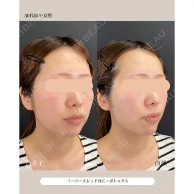 自由が丘ウェルエイジングビューティークリニック 福田 知佐子医師の症例