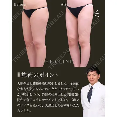 THE CLINIC（ザ・クリニック） 大阪院 黒澤 学医師の症例