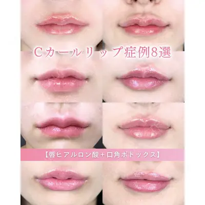 ルラ美容クリニック 新潟院 菊地 泰正医師の症例