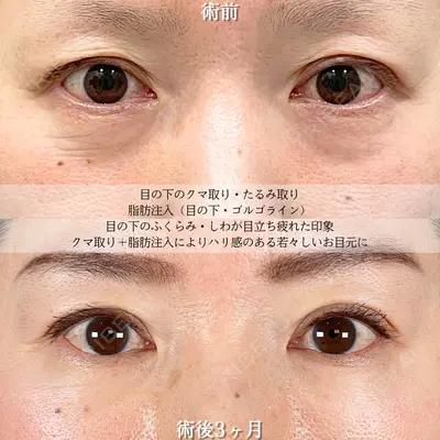 アリエル美容クリニック 大宮院 鈴木　桂介医師の症例