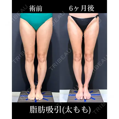 HAAB×DREAM BEAUTY CLINIC 東京本院 吉岡 修一医師の症例