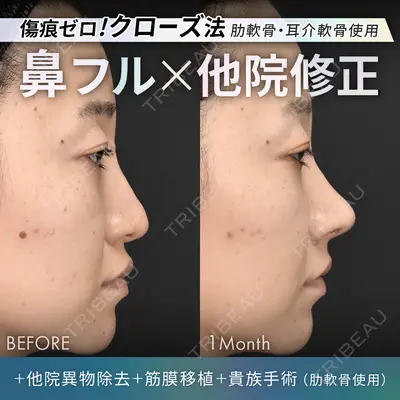 ジョウクリニック 銀座院 重本　譲医師の症例