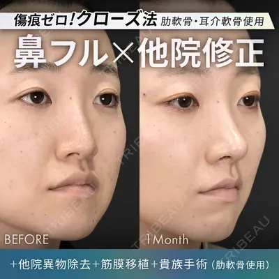 ジョウクリニック 銀座院 重本　譲医師の症例