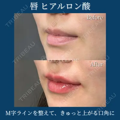 ECLA CLINIC (エクラクリニック) 緒方 善孝医師の症例