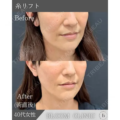 ブルームクリニック（BLOOM CLINIC） 大西 雅樹医師の症例