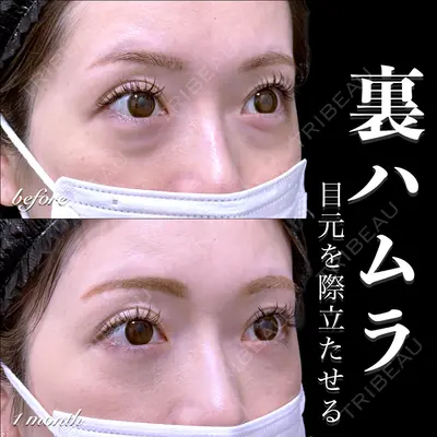 EMMO FACE CLINIC 大宮院 百瀬 直也医師の症例