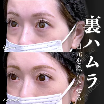 EMMO FACE CLINIC 大宮院 百瀬 直也医師の症例