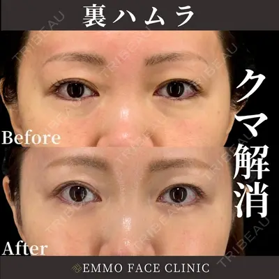EMMO FACE CLINIC 東京三田院 木之下 哲彦医師の症例