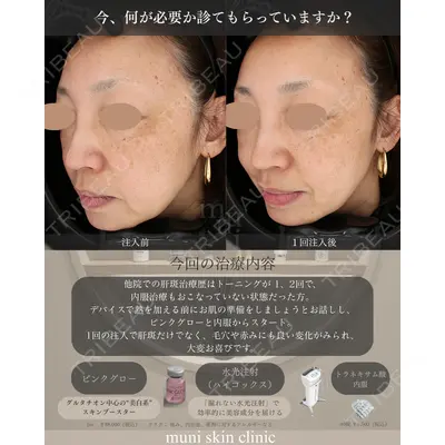 muni skin clinicの症例