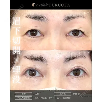 eクリニック 福岡院 伊藤 渉医師の症例