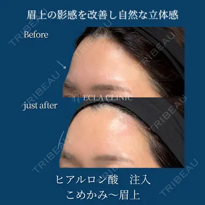 ECLA CLINIC (エクラクリニック) 緒方 善孝医師の症例