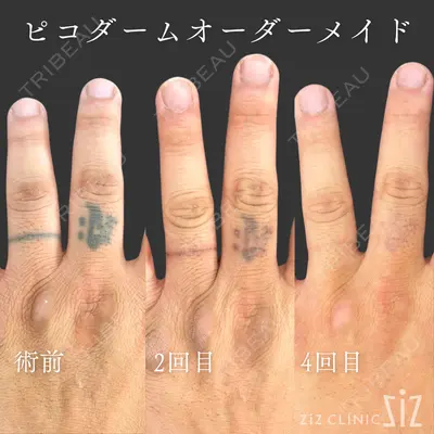 ziz CLINIC 村岡 史子医師の症例