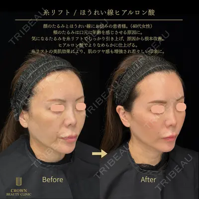 CROWN BEAUTY CLINIC 神山 豊医師の症例
