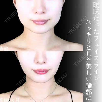 アリエル美容クリニック 大宮院 江郷隼一郎医師の症例