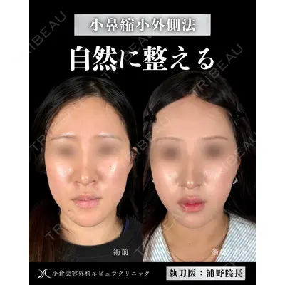 小倉美容外科ネビュラクリニック 浦野 正樹医師の症例