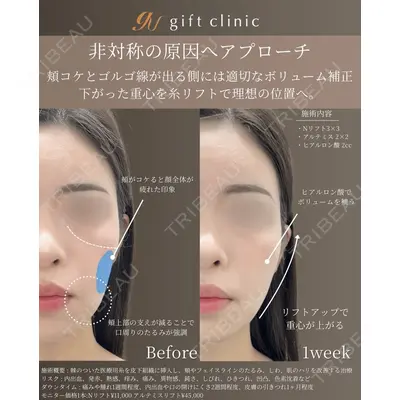 gift clinic 能登谷 翔医師の症例