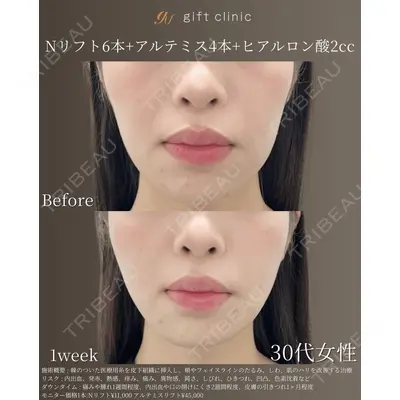 gift clinic 能登谷 翔医師の症例